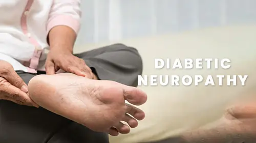 The Painex Diabetic Neuropathy