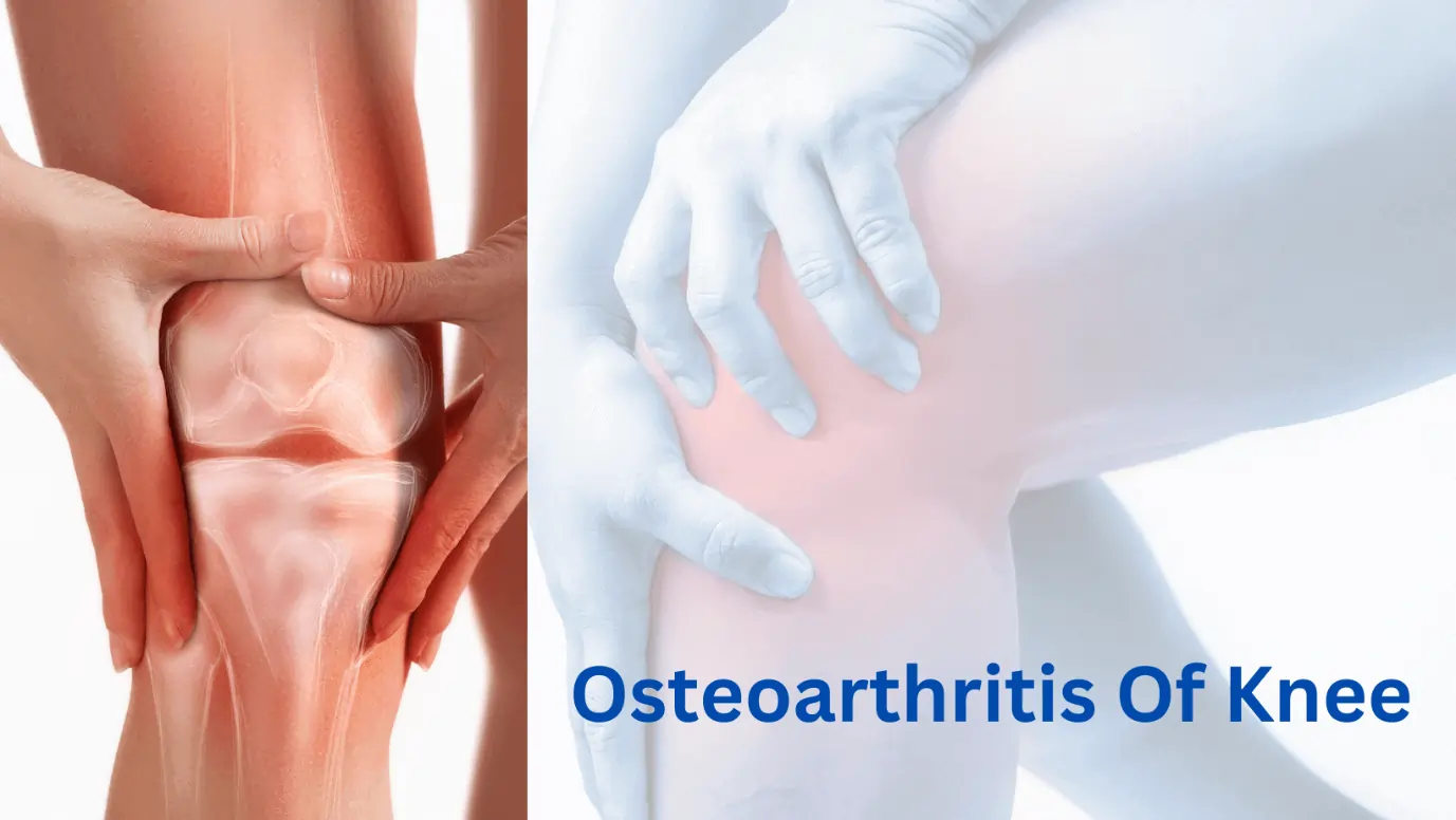 The Painex Knee Pain Treatment